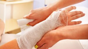 Close-up of a person's hand and forearm being wrapped in a white gauze bandage by two other sets of hands.
